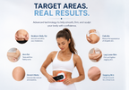 Cellulite Treatment & Body Sculpting Massager – Stretch Mark Removal Device with RF Skin Tightening, EMS Microcurrent & Red Light Therapy